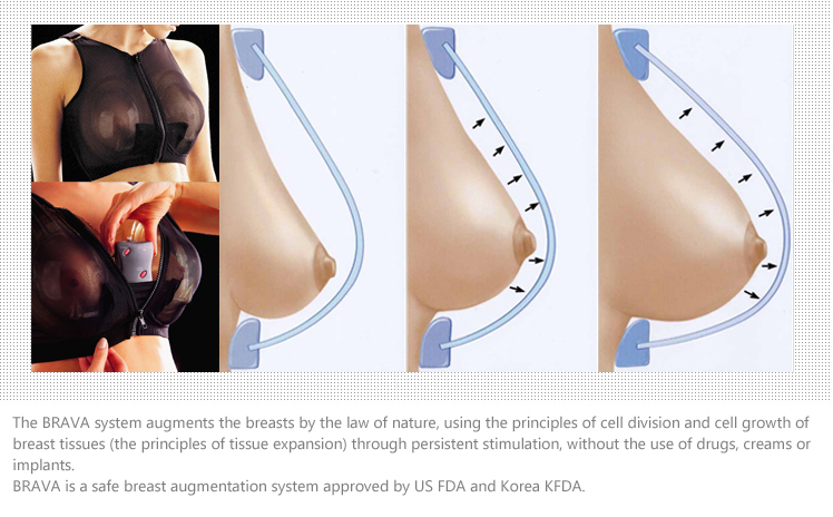 BRAVA Images / BRAVA is a safe breast augmentation system approved by US FDA and Korea KFDA. 