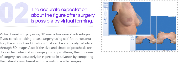 The accurate expectation about the figure after surgery is possible by virtual forming.