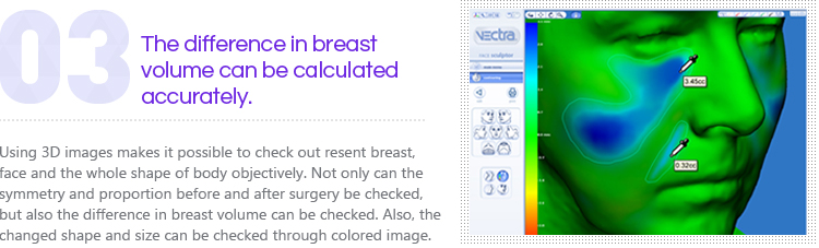The difference in breast volume can be calculated accurately.